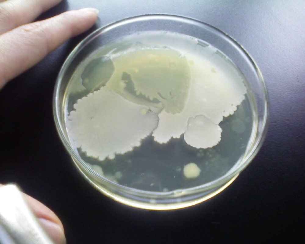 切削液中的杀菌和抑菌有什么区别？